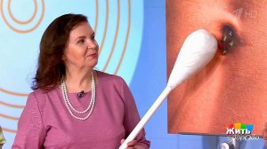 Про пупок. Жить здорово! Фрагмент выпуска от 28.06.2017