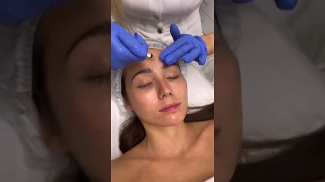 ReVitaPeel демонстрация процедуры смотреть онлайн