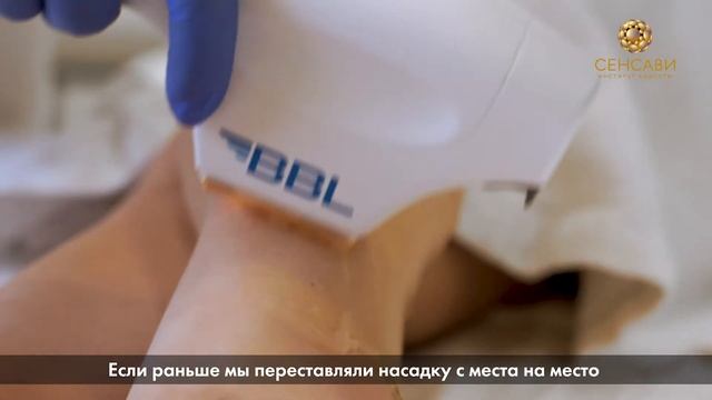 Фотоэпиляция BBL Forever Bare Hero фотоэпиляция смотреть онлайн
