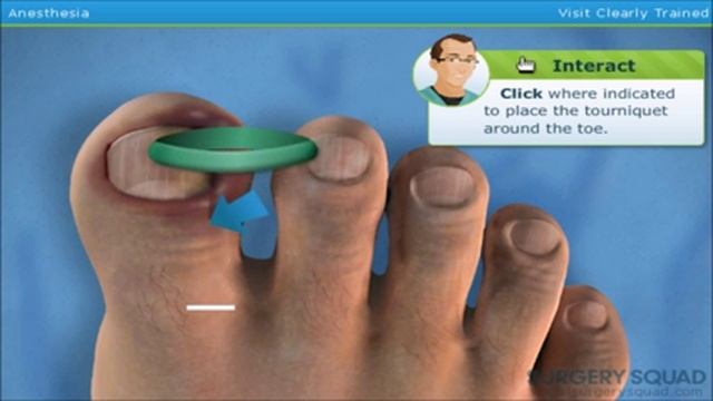 Top Way To Play Surgery Squad Ingrown Toenail Simulator смотреть онлайн