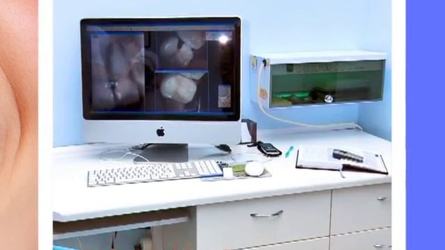 Реклама стоматологической клиники "Exeline" смотреть онлайн