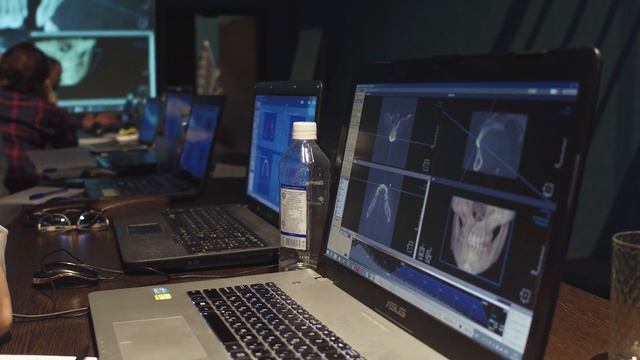 Радиодиагностика челюстно - лицевой области