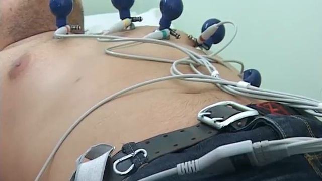 Врачи рекомендуют не заниматься самолечением смотреть онлайн