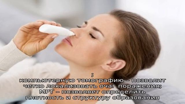 Остеома лобной пазухи смотреть онлайн