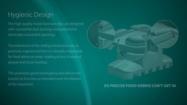 The Agility® Self-Ligating Passive Bracket System смотреть онлайн