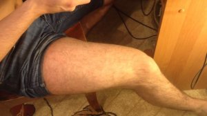 Инструкция: Как поставить укол самому себе в ногу (Внутримышечная инъекция в бедро)