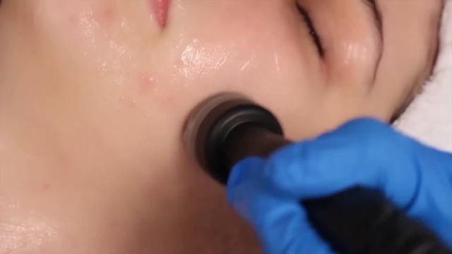 BayAreaBeauty JetPeel смотреть онлайн