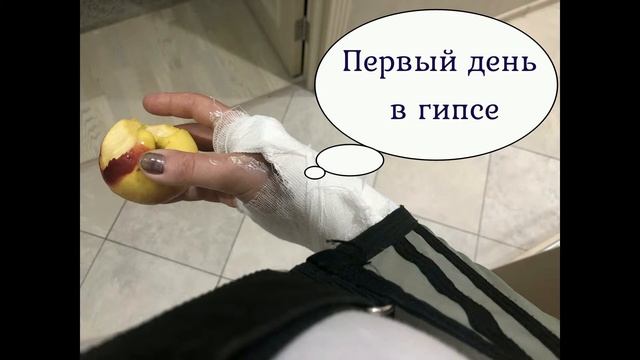 Перелом руки. Все стадии заживления. Советы переломанным. Нетрадиционные способы лечения смотреть онлайн