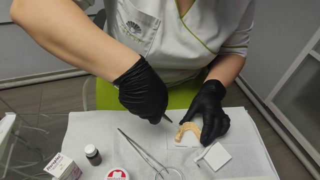 Покриття зубів фторлаком смотреть онлайн