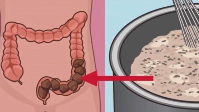 Самый ЛУЧШИЙ РЕЦЕПТ от ЗАПОРА ? ЛЕГКО очистит КИШЕЧНИК смотреть онлайн