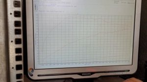 Peugeot 107 turbo. Обзор проделанной работы по установки турбокита и финальная настройка.