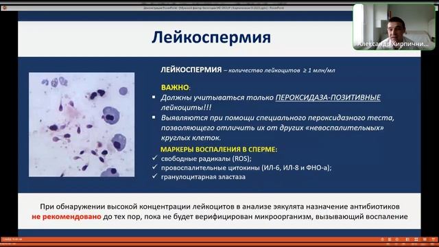 Мужской фактор бесплодия. Андролог А. А. Кирпичников #бесплодие #андролог #мужское #беременность