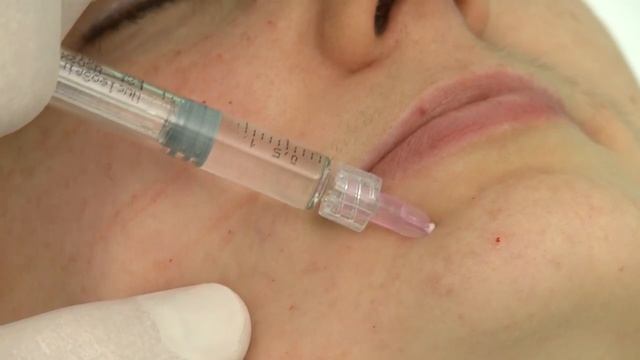 Биоревитализация / Biorevitalization смотреть онлайн