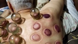 Снимаем банки