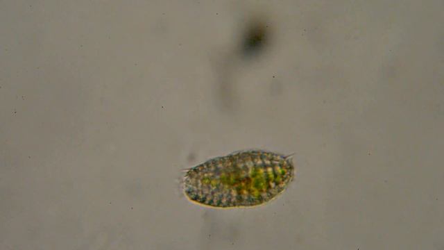 Инфузория Coleps смотреть онлайн