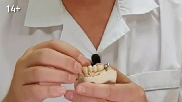 Урок 9 Удалён передний зуб Что делать? Метало-керамика\ Цирконий\ Съёмный протез\ смотреть онлайн