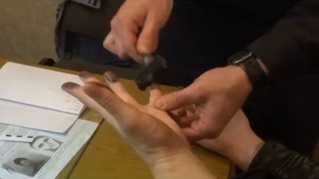Мужчина обратился в травмпункт спустя 2 недели после праздников смотреть онлайн