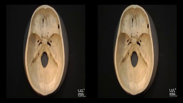 Anatomie 3D de l'étage antérieur de la base du crâne смотреть онлайн