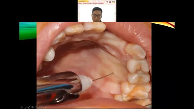 Dr. Doan Lam Tu, DDS, MSc. - Novel biomaterials in oral surgery смотреть онлайн