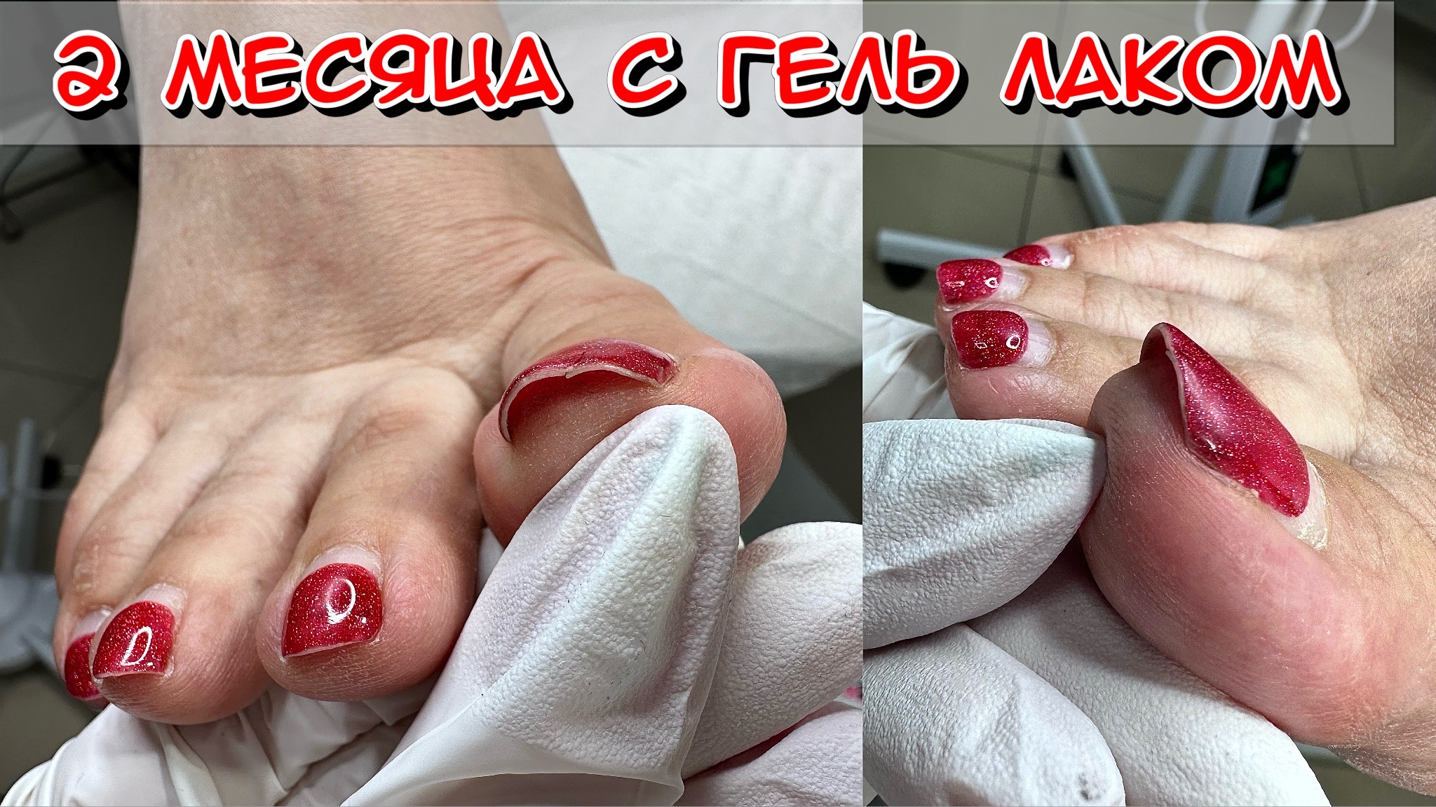 2 месяца с гель лаком / Полный педикюр / Плюс бонус зачистка трещины смотреть онлайн