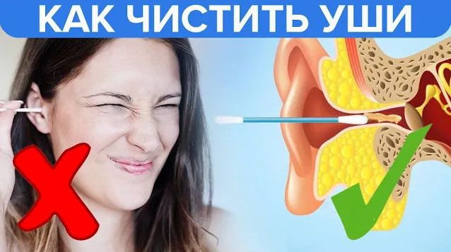 Как правильно чистить уши | Правильная гигиена ушей! - Доктор 24 смотреть онлайн