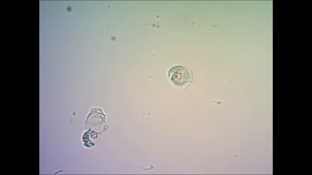 Инфузория крутится under microscope смотреть онлайн