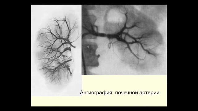 12:00 Методы обследования больных с патологией почек