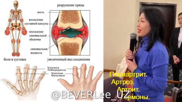 Довольна результатами, благодаря кальций и коэнзим QH смотреть онлайн