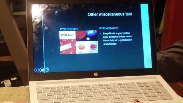 MLS 461 E coil and Entercoccus faecalis case study. Ms. Campbell смотреть онлайн