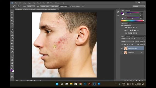 How to remove acne and pimples in photoshop | photoshop skin retouching Tutorial смотреть онлайн