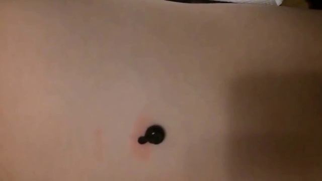 Вперше ставимо пиявки дитині. Боляче? смотреть онлайн