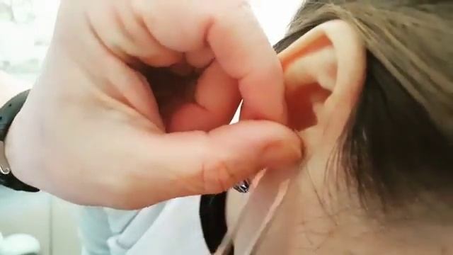 Иглоукалывание смотреть онлайн