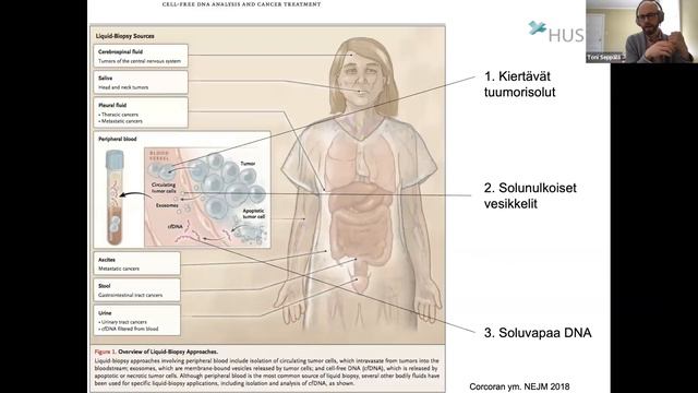 Lynchin syndrooma-webinaari 22.3.2021 смотреть онлайн