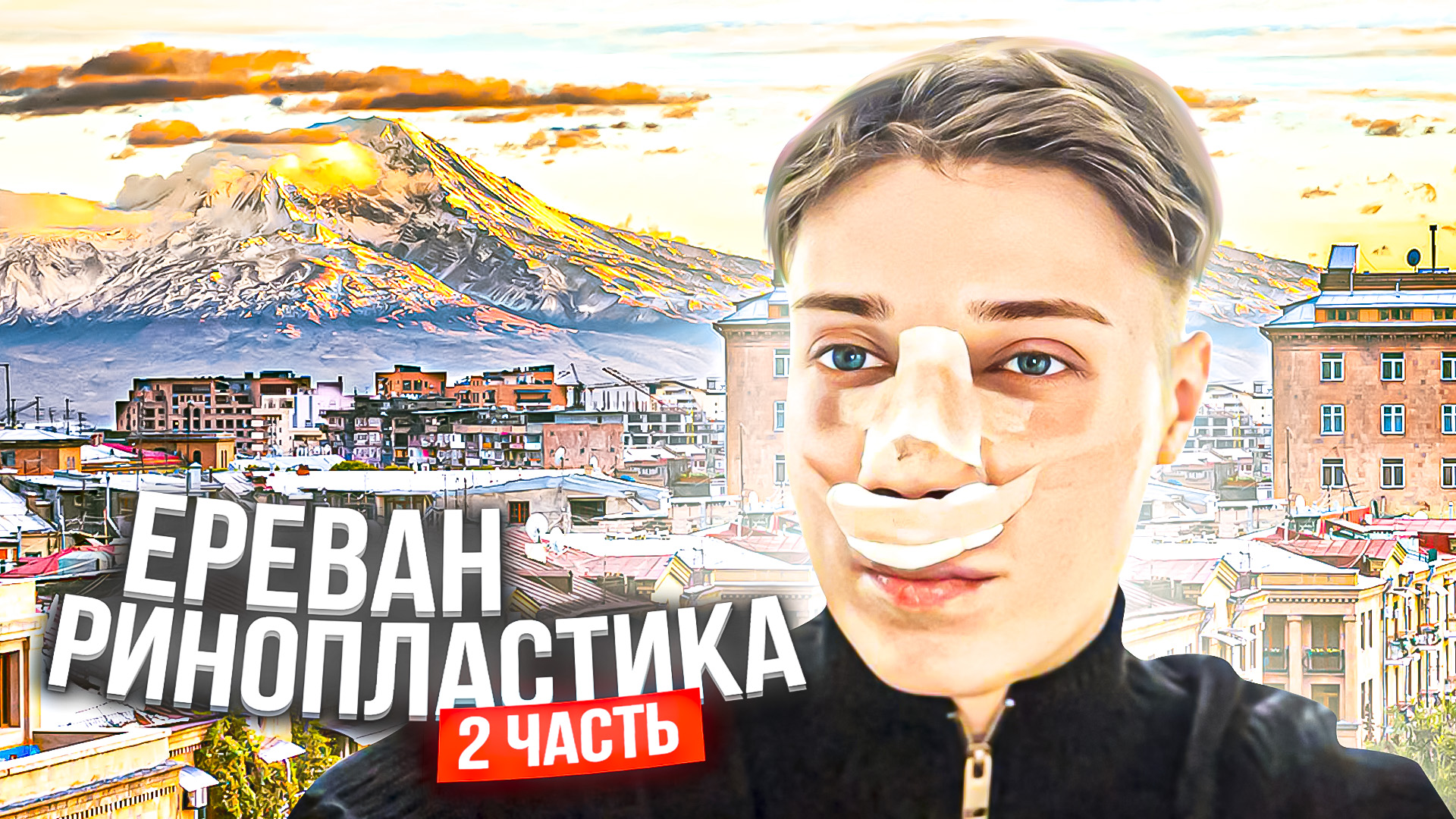 ЕРЕВАН РИНОПЛАСТИКА | ЧАСТЬ 2 смотреть онлайн
