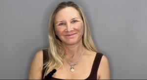 Реабилитация после подтяжки лица.