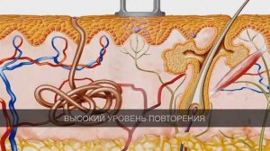 Лазер высокой интенсивности BTL 6000 HIL  Особенности технологии и медицинские эффекты