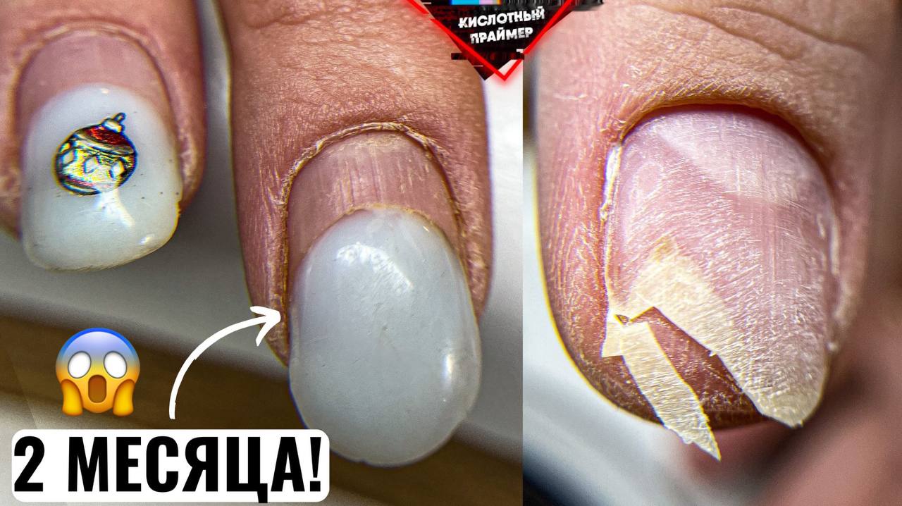 Кислотный Праймер