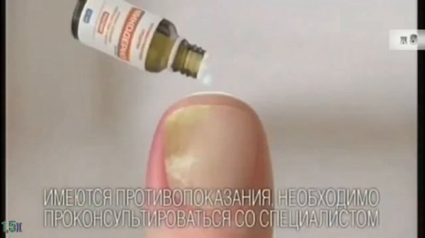 Микодерил — «С грибком справляться научил» в 8х быстрее | PRO Рекламу