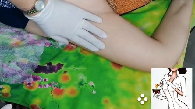 Depilation with sugar paste on women's armpits. Hair after razor. Удаление волос на подмышках. смотреть онлайн