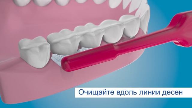 Правильный уход за имплантами. Зубная щетка TePe Implant Brush. смотреть онлайн