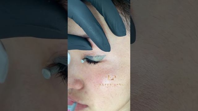 ТРЕШ ТАТУАЖ! Удаляем за минуту стрелочку! смотреть онлайн