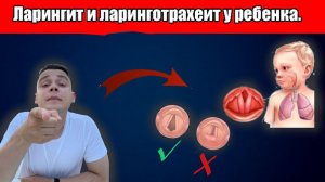 Ларингит и ларинготрахеит у ребенка. Алгоритм действия для мамы.