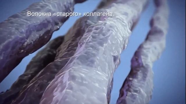 Механизм действия SMAS лифтинга