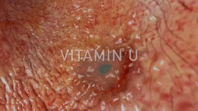 DRINK 1 CUP PER DAY to Reduce Inflammation from Your Intestines смотреть онлайн