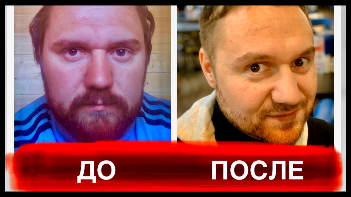 Алкоголизм До и После! Мой опыт 4 года без спиртного! Результат на лицо! смотреть онлайн