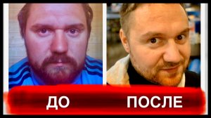 Алкоголизм До и После! Мой опыт 4 года без спиртного! Результат на лицо!