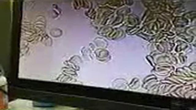 Наблюдение под микроскопом действие на иммунитет спреев Alivemax ! смотреть онлайн