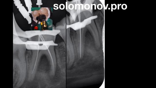 Разбор клинического случая - от диагностики к лечению и наблюдению смотреть онлайн