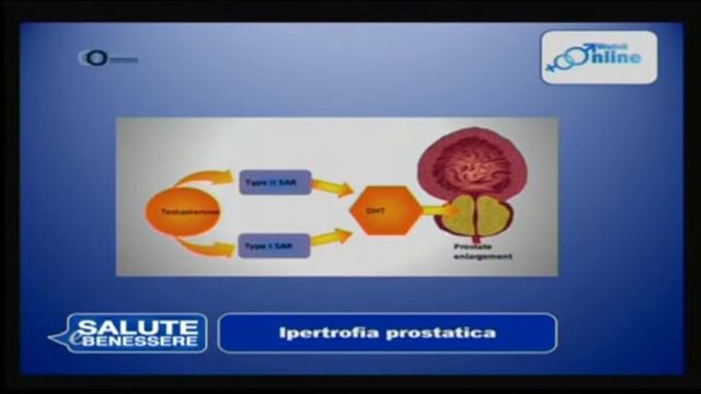 Ipertrofia prostatica смотреть онлайн