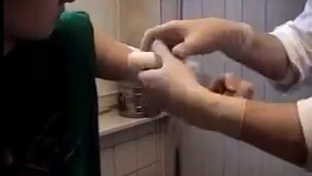 Повязка на локтевой сустав (второй тип) смотреть онлайн